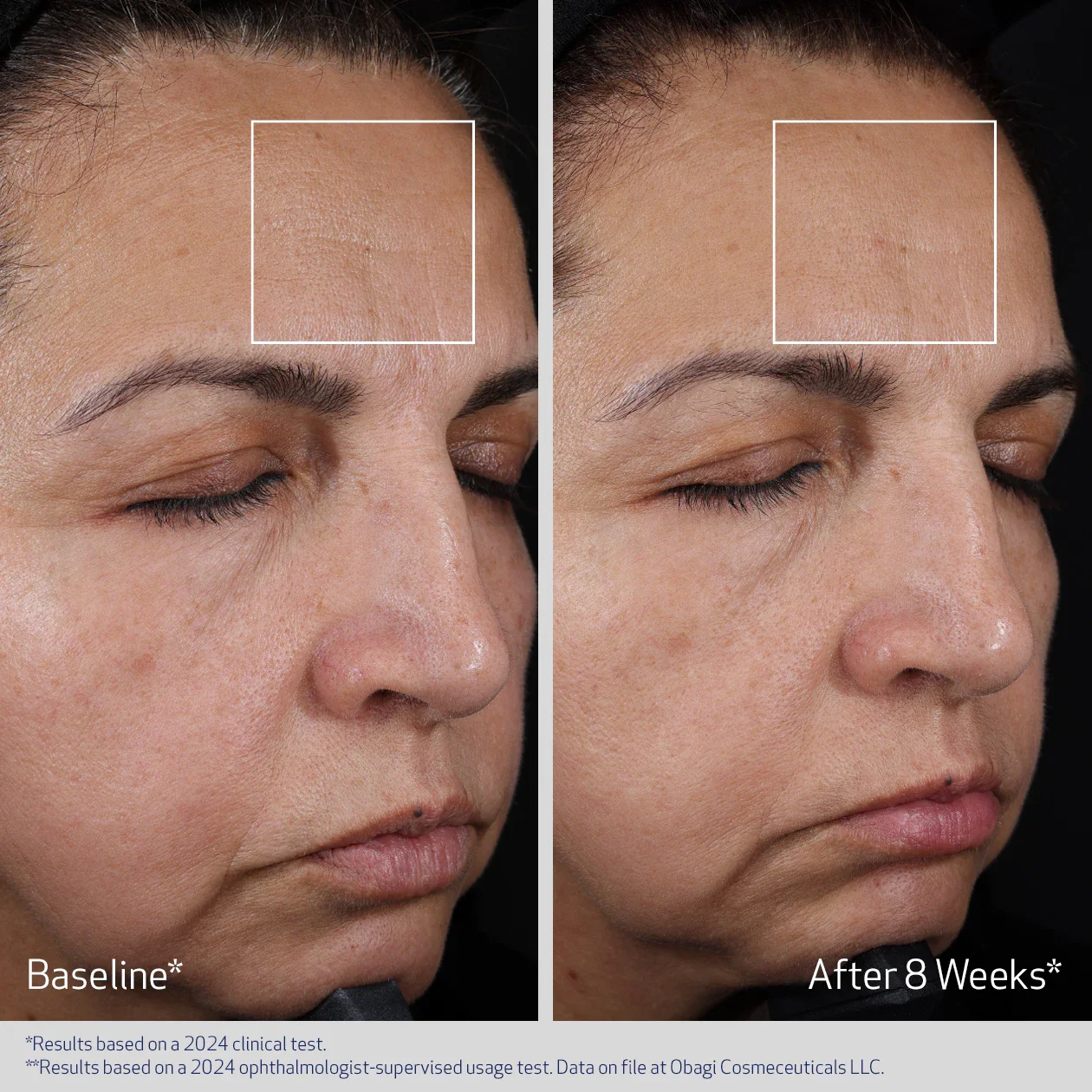 ADVANCED FILLER CONCENTRATE - Image 5