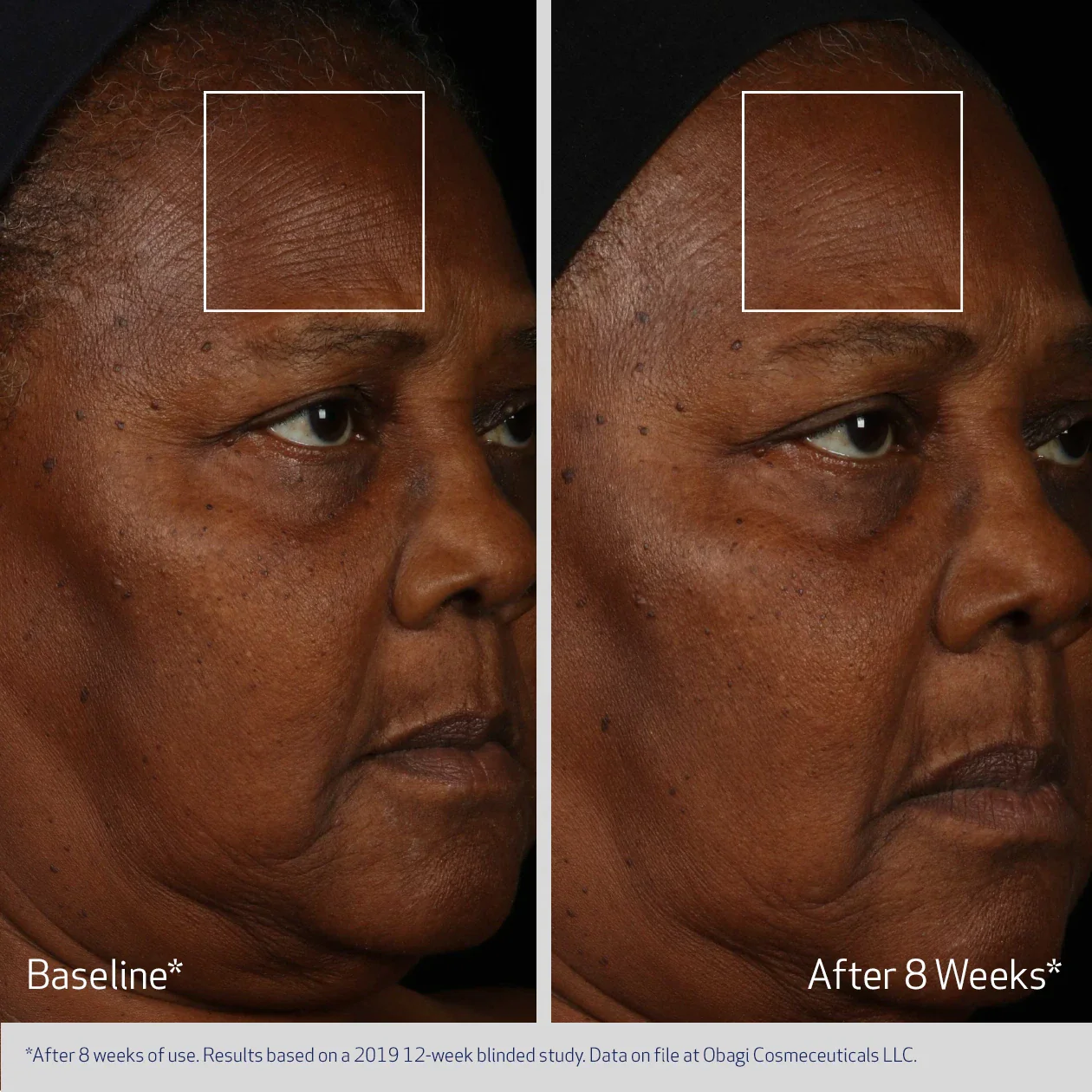 FACIAL SERUM - Image 4