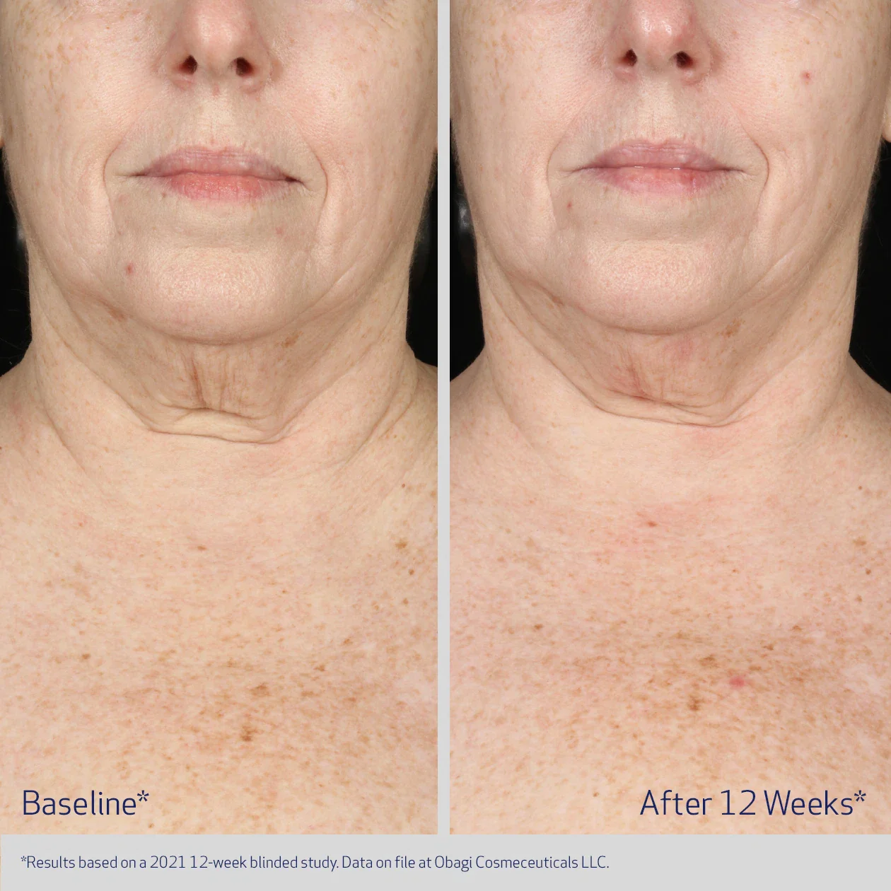 NECK AND DÉCOLLETÉ CONCENTRATE - Image 5