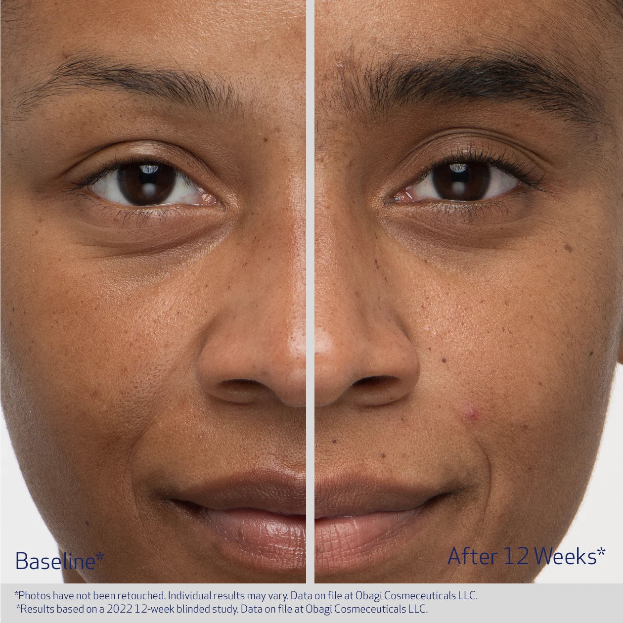 EYEBROW BOOSTING SERUM - Image 5